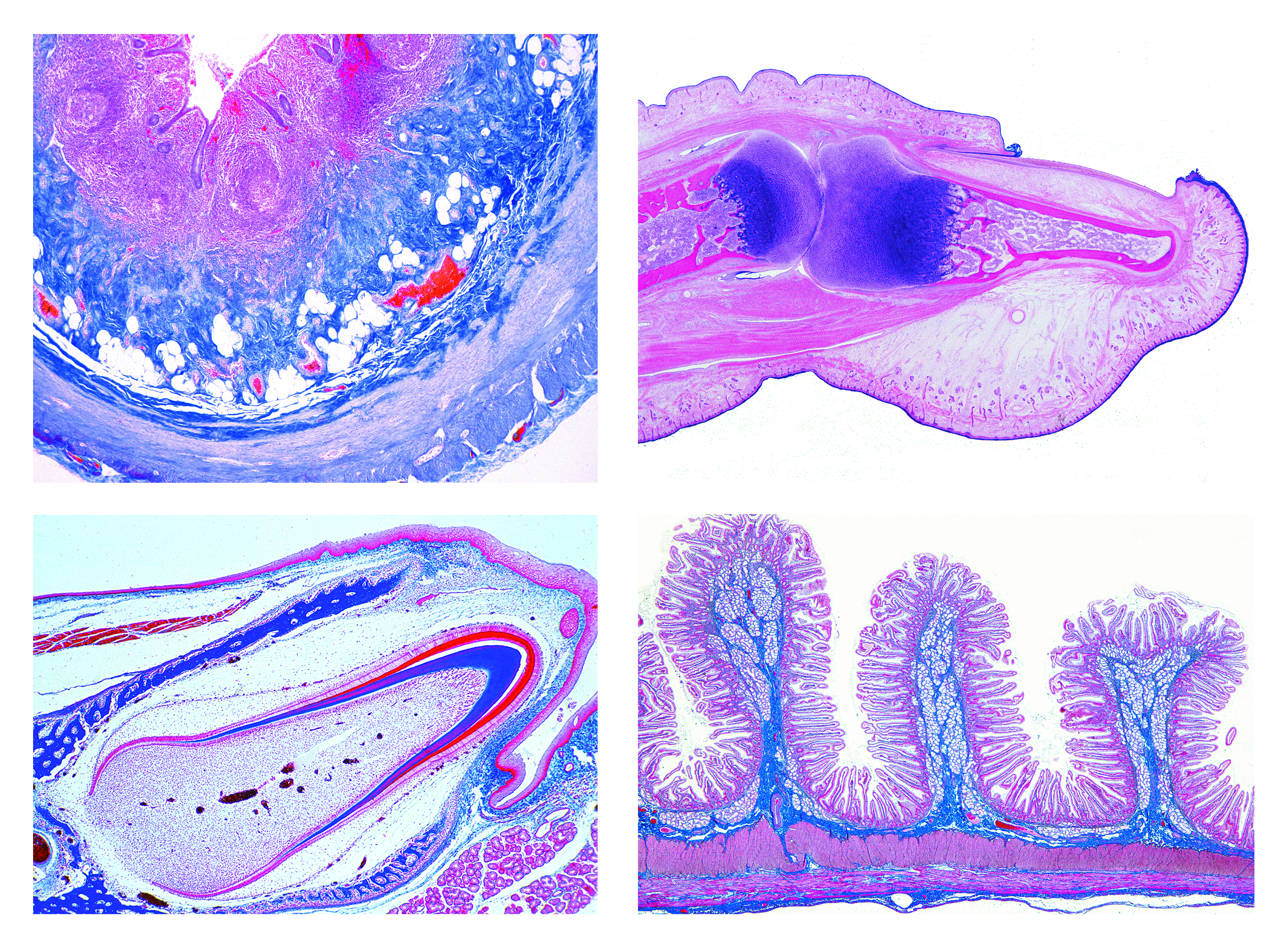 Human tissue